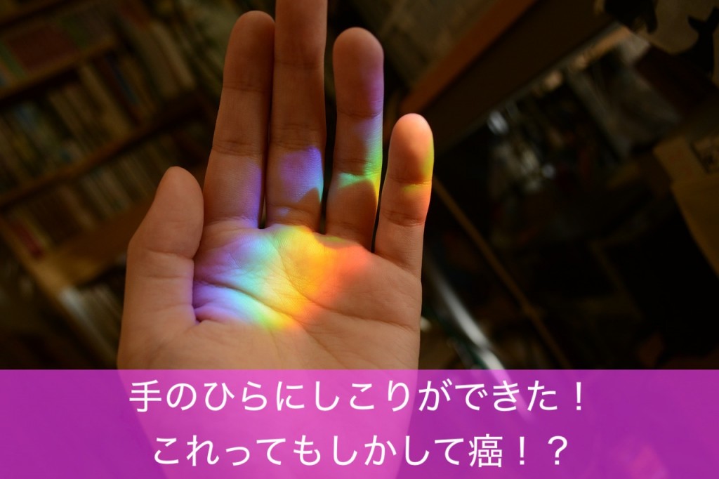 手のひらにしこりができた これって癌!?